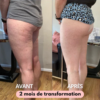 ZYRO™ – Leggings 3D Anti-Cellulite